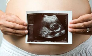 Допплерография при беременности - обязательное исследование - Что исследуется на УЗИ Доплера