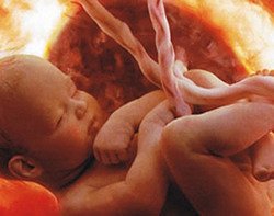 34 неделя беременности 34 неделя беременности