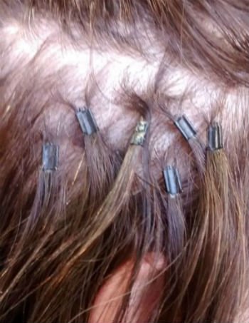 127872 Последствия наращивания волос: какой вред состоянию головы могут нанести неудачное ленточное и плохое капсульное удлинение, а также фото до и вслед за снятием - Особые ситуации