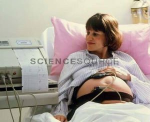 КТГ при беременности: особенности исследования и расшифровка результатов - Цели проведения КТГ