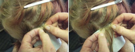 Как снять нарощенные волосы в домашних условиях: обзор способов